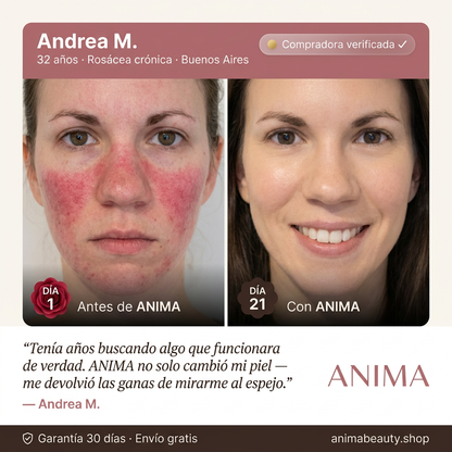 Crema Natural ANIMA - Chau Rosacea (Reduce la rojez en 7 Días)